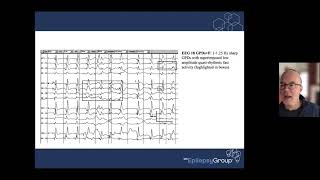 ICTAL INTERICTAL CONTINUUM 20211110 132939 Meeting Recording 1 [upl. by Myrilla]