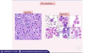 Odontogenic cysts and Histology of radicular cyst  NEET MDS  Oral pathology [upl. by Piggy]