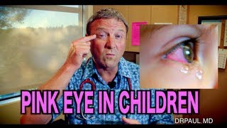 Pink Eye In Children  Pediatric Advice [upl. by Lirrehs]