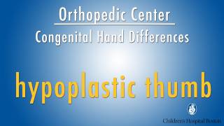 hypoplastic thumb  congenital hand differences  Boston Childrens Hospital [upl. by Clevey]