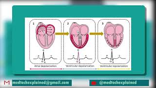 ECG FAST TRACK part 16 Normal sinus rhythm [upl. by Alekin531]