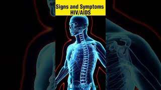 Signs and Symptoms of HIVAIDS [upl. by Yarahs]