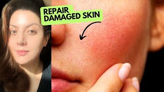 Repair your damaged skin barrier in 1 week  How to treat different types of skin damage correctly [upl. by Nosydam953]