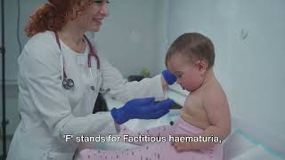 Hematuria in Children  The Differential Diagnosis With Fraterne ZU medicalexcellencecenter [upl. by Naicul]