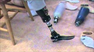 prosthetic leg assembly Echelon  Perfect StrideUltra Strideflex foot [upl. by Dreddy]