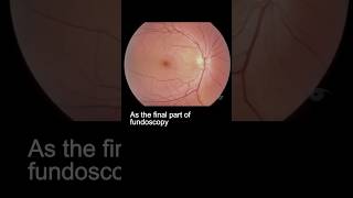 Examining the fundus – part 3 ophthalmology [upl. by Allebasi]