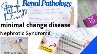 minimal change disease  nephrotic syndrome  renal pathology lectures  selflessmedicose [upl. by Aihsilef]