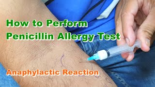 Penicillin G Allergy Test  Benzylpenicillin  Type 1 Hypersensitivity Reaction  How to Do [upl. by Engracia]