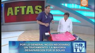 Doctor TV Sepa diferenciar un afta del cáncer 140813 [upl. by Rempe901]