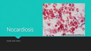 NOCARDIOSIS Y ACTINOMICOSIS  MICOLOGIA [upl. by Ozkum]