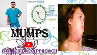 Mumps Virus  Paramyxovirus  Virology [upl. by Esorrebma]