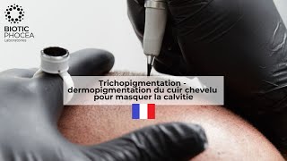 Trichopigmentation  dermopigmentation du cuir chevelu pour masquer la calvitie [upl. by Tnecillim]