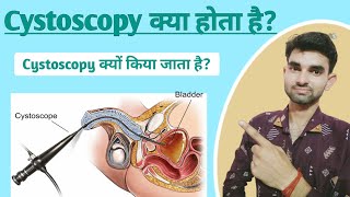 Cystoscopy in Hindi  Cystoscopy meaning  Purpose and Complications of Cystoscopy [upl. by Uyekawa]