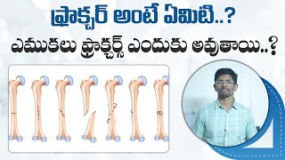 fractureseries  Basics of Fractures  Fracture  Bone Fracture  Dr Vamshis Orthopaedic Center [upl. by Cleveland]