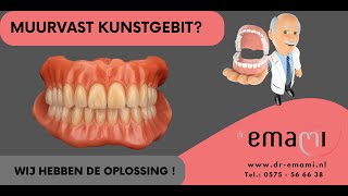 Kunstgebit gehemelte vrije kunstgebit implantaat klickgebit frictie stegprothese [upl. by Eellac13]