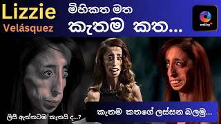 LIZZIE VELASQUEZ  මිහිකත මත කැතම කතගේ ලස්සන [upl. by Hourigan]