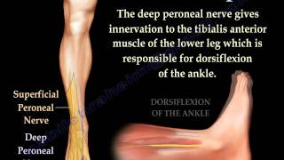 Foot Drop Peroneal Nerve Injury  Everything You Need To Know  Dr Nabil Ebraheim [upl. by Ahtelra]