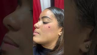 Aplicação de microdermal com agulha americana [upl. by Itraa]