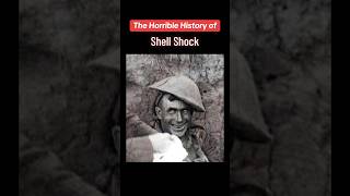 The Shocking History of “Shell Shock” [upl. by Anoirb]