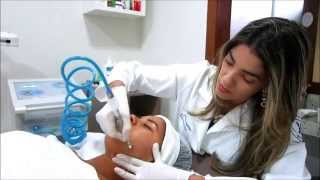 Peeling para tratamento de Acne manchas e rejuvenescimento  JULIANA MARTINS [upl. by Norvell]