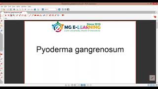 Pyoderma Gangrenosum  Dermatology  Davidson Medicine [upl. by Colbert]