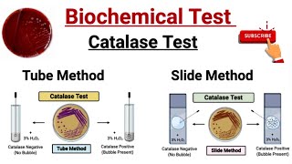 Biochemical Test For identification of Bacteria  Catalase Test  Test Tube Method Slide Method [upl. by Aydni]