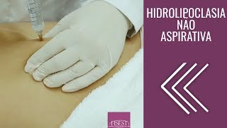 Hidrolipoclasia não Aspirativa Lipo Não Invasiva  Fisest [upl. by Gottwald947]