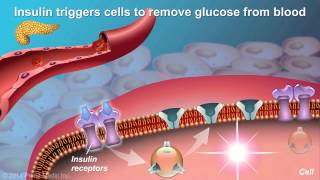 Understanding Type 2 Diabetes [upl. by Dickinson335]