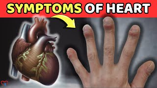 Look Down At Your HAND These 5 Signs Indicate That Your Heart Is Having ISSUES  Vitality Solutions [upl. by Tobi]