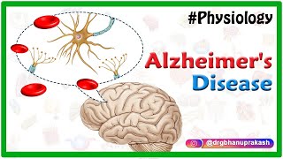 Alzheimers disease  Etiology Pathophysiology Signs and symptoms Diagnosis and Treatment [upl. by Capriola878]