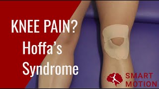 ANTERIOR KNEE PAIN Use this TAPE What to do if you have Hoffas fat pad syndrome [upl. by Ahsrat]