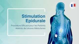 Stimulation Epidurale Procédure Efficace pour les Patients Atteints de Lésions Médullaires [upl. by Eecyaj]