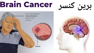 Brain Cancer Causes Symptoms Treatment for Brain Cancer in HindiUrdu [upl. by Yesrod]