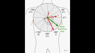 Determination of Mean QRS Axis in Electrocardiography [upl. by Verdie]