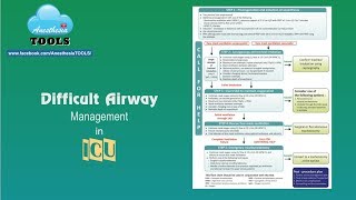 Difficult airway algorithm for ICU [upl. by Roid]