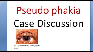 Ophthalmology Pseudophakia History Taking Examination Case Presentation Discussion IOL [upl. by Fortunia]