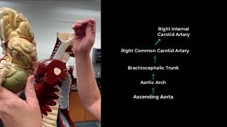 Anatomy of the Circulatory System  Arteries from the Heart to the Brain via the Carotid Arteries [upl. by Ekram]