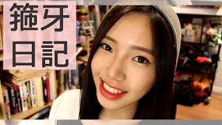 箍牙日記 4 覺得好自卑 ♡ My Braces Diary Most Painful Experience eng sub [upl. by Hallvard]