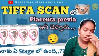 Placenta previa full details in pregnancy🤰 ఇలాఉంటే ఏం చేయాలి🤔 [upl. by Assela]