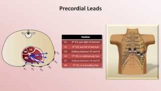 Intro to EKG Interpretation  EKG Leads [upl. by Deana792]