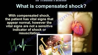 Compensated Shock In Trauma Patients  Everything You Need To Know  Dr Nabil Ebraheim [upl. by Ennovahs]