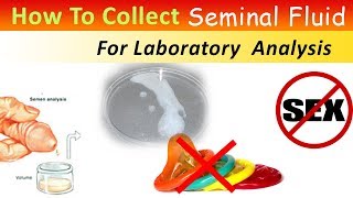 how to collect Seminal fluid For Analysis [upl. by Gustafson]