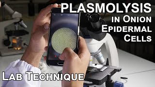 Plasmolysis in Onion Epidermal Cells  Biology Lab Techniques [upl. by Eitsud775]