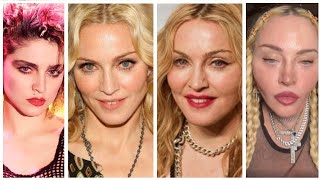 What happened to Madonnas face [upl. by Ariam]