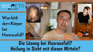 Ist das die Lösung gegen Haarausfall Heilung in Sicht Buch zusammenfassung [upl. by Sikes118]