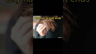 These things do NOT cause balding bald balding baldingsolution haircare hair hairstyle shorts [upl. by Thorn]