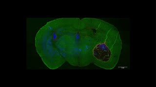 Identifying how a fungus causes damage to the brain [upl. by Winser]