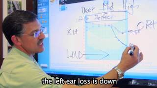 How to read an Audiogram  Better Hearing Center of Austin [upl. by Carisa267]