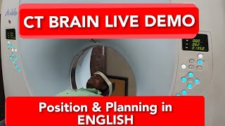 Brain CT scan protocol positioning and planning  Live Demo in English on Toshiba 16 Slice [upl. by Eibob]