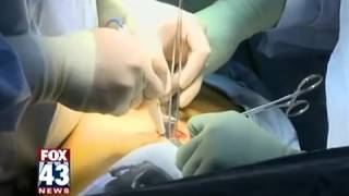 Video Assisted Thoracic Surgery [upl. by Thorvald]